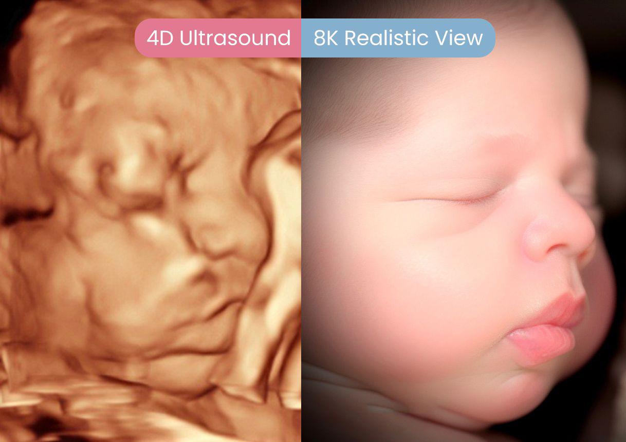 What Is 8K Resolution? Discover the Future of Ultrasound Imaging at MacroBaby