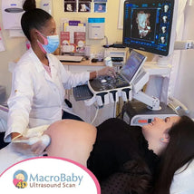 Macrobaby 4D Ultrasound Packages | Orlando, FL - Gold Package