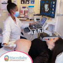 Macrobaby 4D Ultrasound Packages | Orlando, FL - Platinum Package