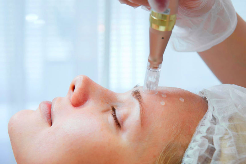 Woman lying down while receiving microneedling treatment on her face