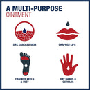 A - A+D Original Diaper Rash Ointment, 1 pound Jar Image 8