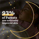 93% of parents reported noticeably improved skin for their babies, with a sleeping baby visible.