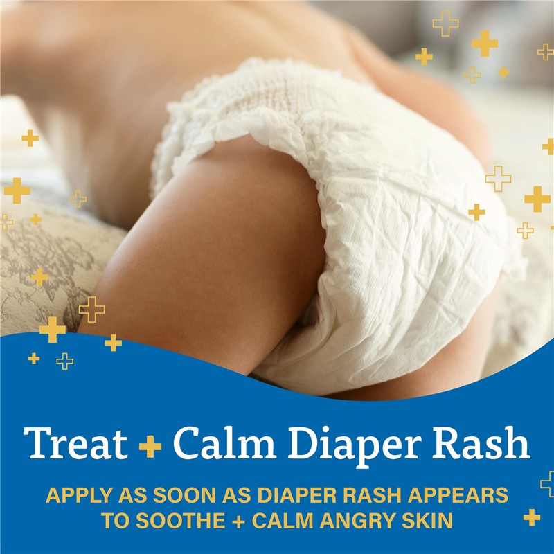 Zinc Oxide Diaper Rash Treatment Cream for babies, with a focus on soothing and calming diaper rash, featuring an infant in a diaper.