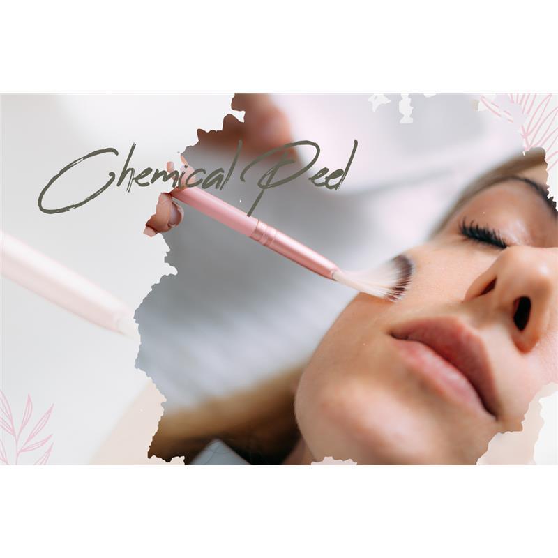 Macro Beauty Spa - Chemical Peel | Orlando, FL Image 1