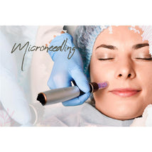 Macro Beauty Spa - Microneedling | Orlando, FL Image 1