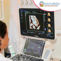 Macrobaby 4D Ultrasound Packages - Gold & 8K Image 2