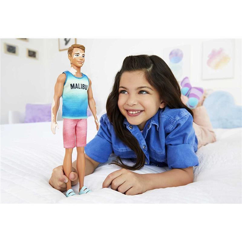 Mattel - Barbie Ken Doll, Cropped Hair & Vitiligo in Malibu T